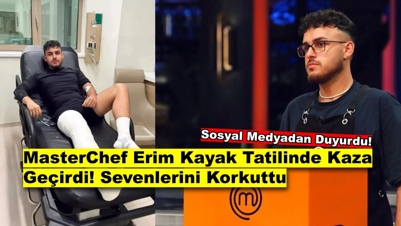 MasterChef Erim Kayak Tatilinde Kaza Geçirdi! Bacağını Kırdığını Duyurdu