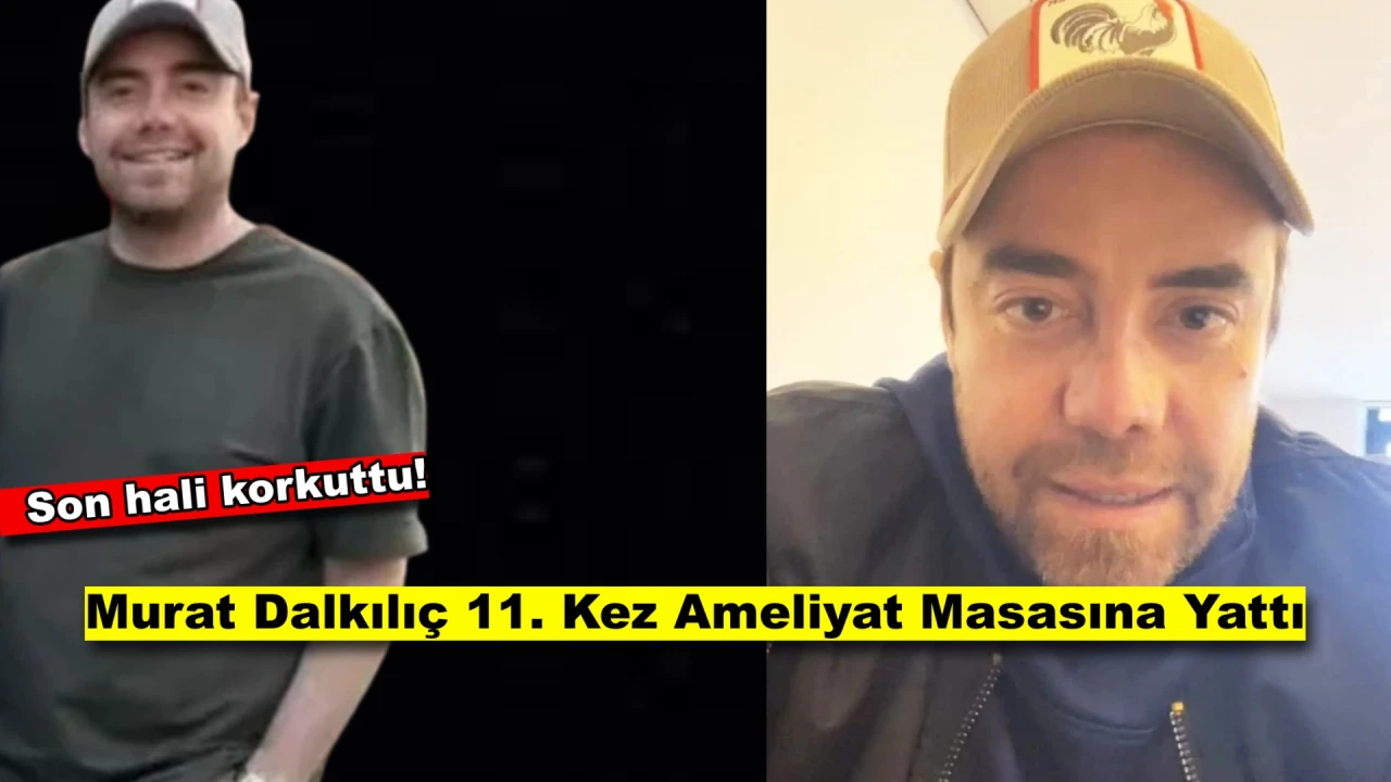 Murat Dalkılıç'ın Son Görüntüleri Sevenlerini Üzmüştü, Ünlü Şarkıcı Tekrar Bıçak Altına Yattı!
