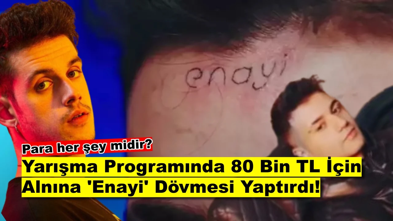 Orkun Işıtmak'ın Yarışmacısı 80 Bin TL Uğruna Alnına 'Enayi' Yazdırdı! Dövme Gerçek mi?