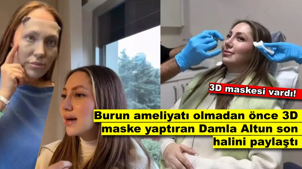 Ameliyat Öncesi 3D Maske İle Prova Yapmıştı, Son Halini Paylaştı!