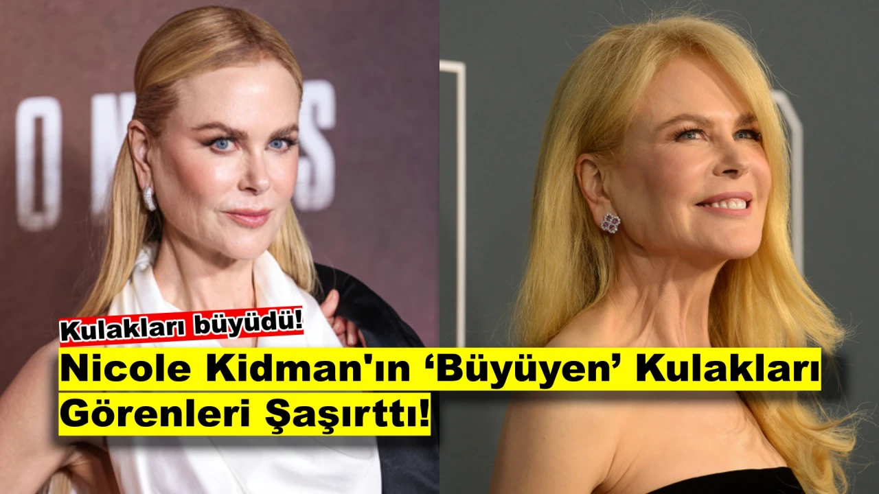 Nicole Kidman’ın Kulaklarındaki Büyüme Gündeme Oturdu!