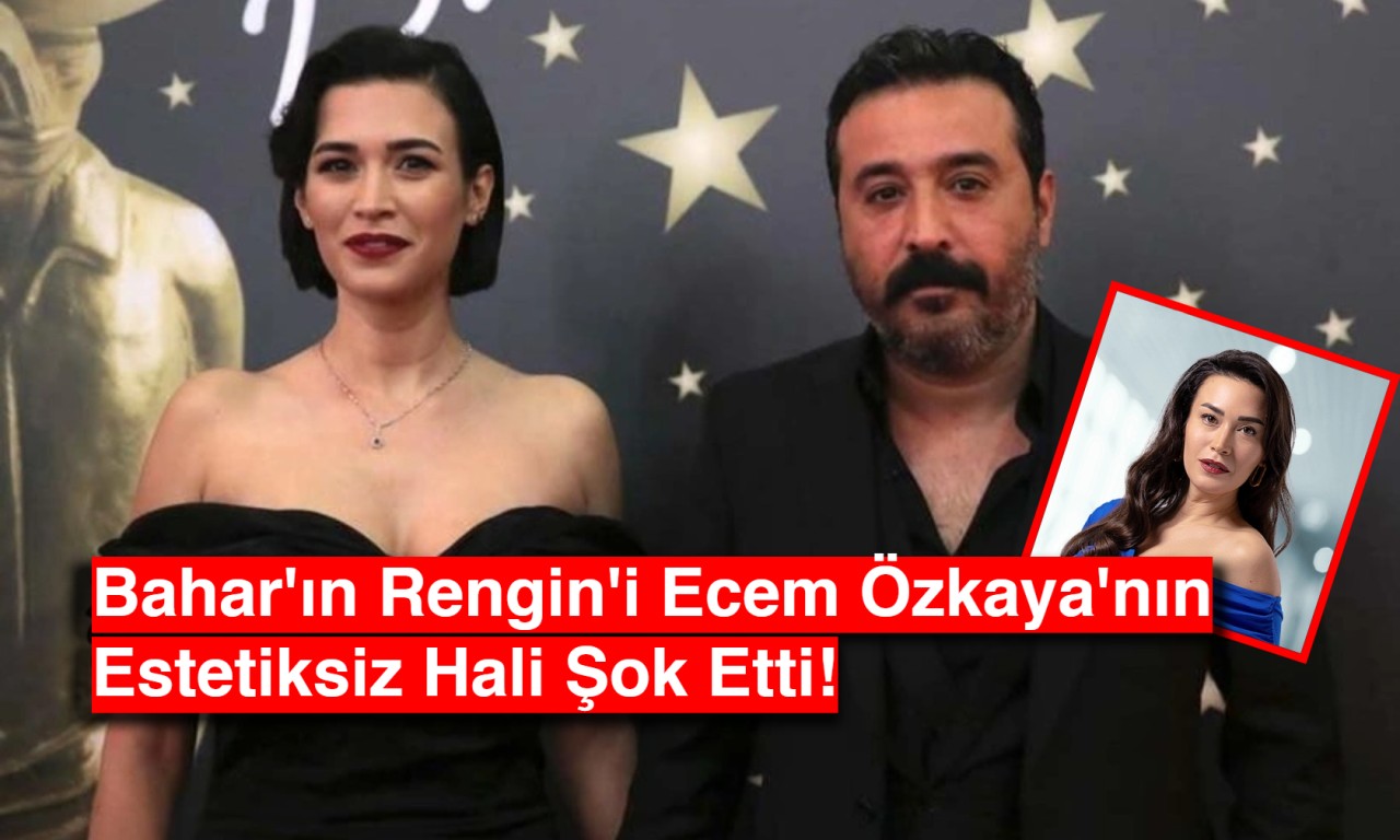 Bahar'ın Rengin'i Ecem Özkaya'nın Estetiksiz Hali Şok Etti!