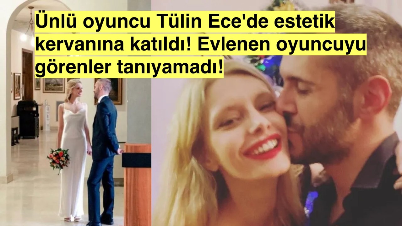 Tanıyabilmeniz Mümkün Mü? Ünlü Oyuncu Evlendi ve Görüntüsüyle Herkesi Şoke Etti!