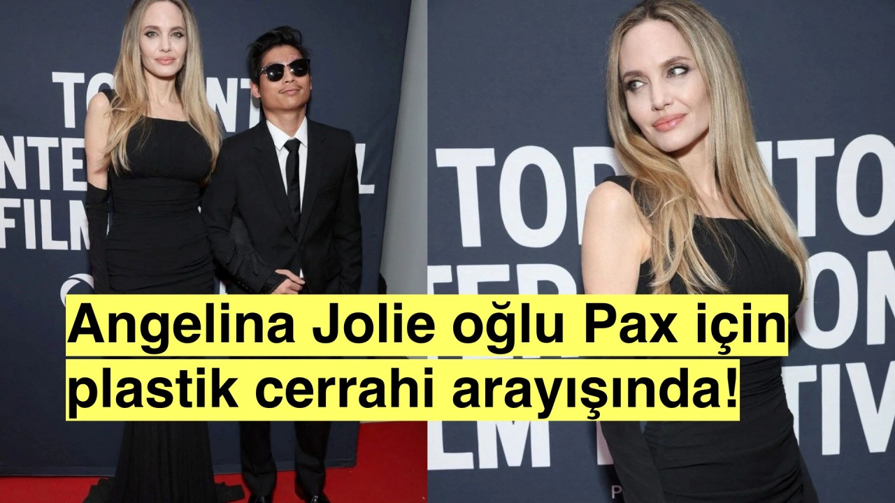 Angelina Jolie oğlunun alnındaki yara izi için en deneyimli plastik cerrahlarıyla görüşüyor