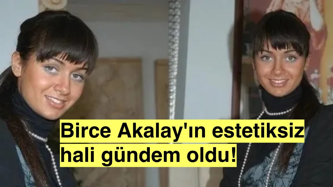 Birce Akalay'ın estetiksiz hali hayranlarını şaşırttı