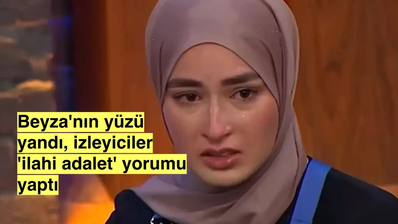 MasterChef Beyza'nın yüzü yandığı iddia edildi 'ilahi adalet' yorumları geldi