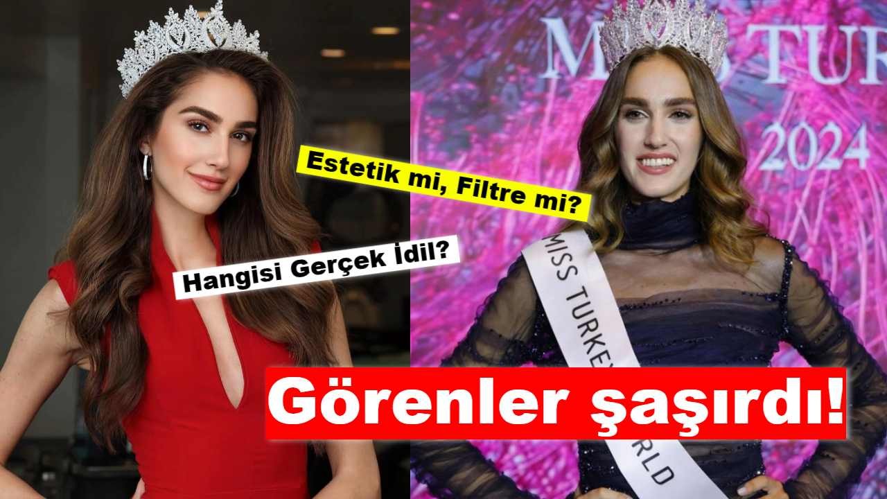 İdil Bilgen Sosyal Medyayı Salladı: Estetik mi, Filtre mi Tartışmaları Sürüyor!