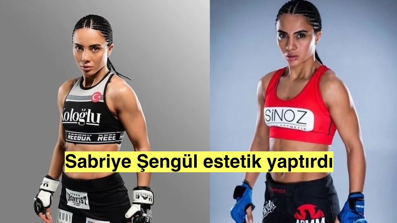 Survivor Sabriye Şengül estetik yaptırdı yeni hali sosyal medyada eleştirildi