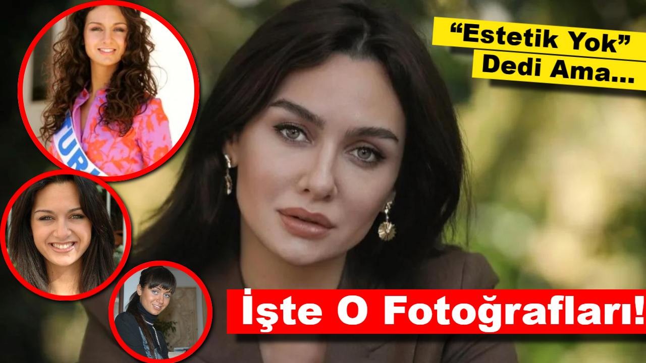 “Estetik Yok” Dedi Ama… İşte Birce Akalay’ın O Fotoğrafları!