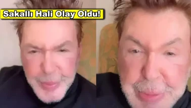 Kuşum Aydın son haliyle olay oldu, sakallı hali gündemde!