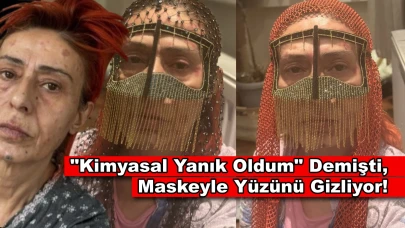 Yüzünde Kimyasal Yanıklar Oluşan Yıldız Tilbe Çareyi Maske Takmakta Buldu!