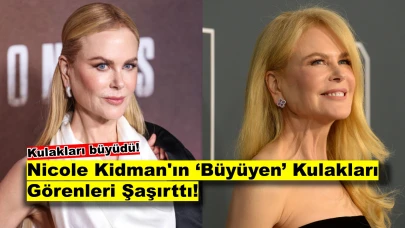 Nicole Kidman’ın Kulaklarındaki Büyüme Gündeme Oturdu!