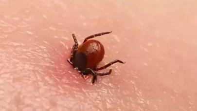 Kenenin ısırdığı 77 yaşındaki kadın hayatını kaybetti