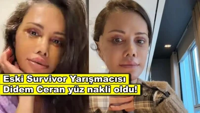 Eski Survivor yarışmacısı Didem Ceran yüz nakli oldu!