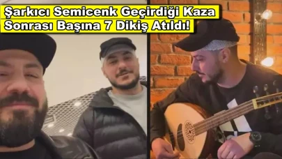 Semicenk evinde kaza geçirdi, şarkıcının başına 7 dikiş atıldı!