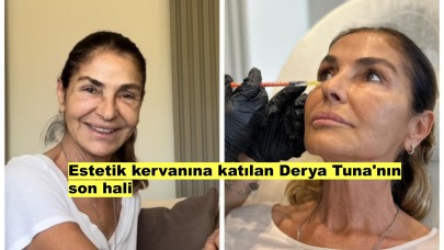 Derya Tuna Yeni Yüzüyle Hayranlarını Şaşırtıyor!