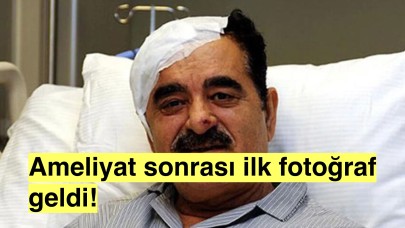 Hayranlarını Endişelendiren O Ameliyattan Sonra İlk Haber! Tatlıses'ten Fotoğraf Geldi