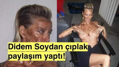 Didem Soydan Şeyma Subaşı'nı örnek aldı: Çıplak fotoğraflarını paylaştı!