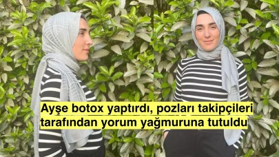 MasterChef Ayşe botox yaptırdı, takipçilerinin gözünden kaçmadı