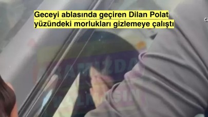 Dilan Polat yüzündeki morlukları gizlemek için korumalarını kullandı, kocasıyla arası bozuk olan Dilan polat geceyi ablasında geçirdi