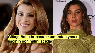 Gökçe Bahadır, eşinin doğum günü kutlamasında yanan saçının son halini paylaştı