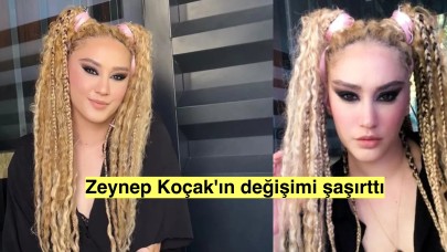 Çok Güzel Hareketler Bunlar programının Zeynep'i yaptırdığı estetiklerle bambaşka birine döndü