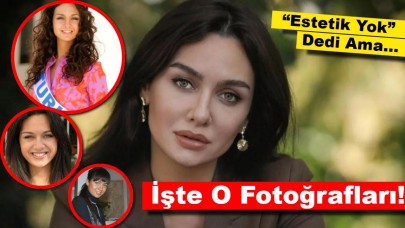 “Estetik Yok” Dedi Ama… İşte Birce Akalay’ın O Fotoğrafları!