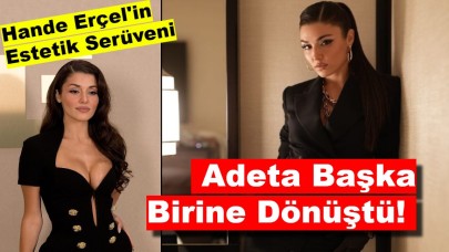 Hande Erçel'in Estetik Serüveni: Adeta Başka Birine Dönüştü!