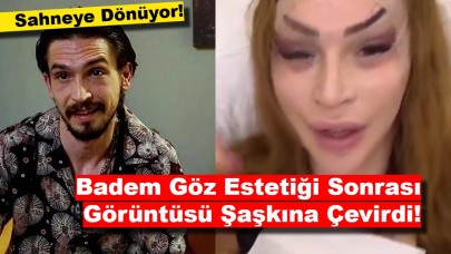 Badem Göz Estetiği Sonrası Görüntüsü Şaşkına Çevirdi!