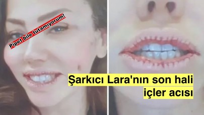 Şarkıcı Lara'nın son hali görenleri üzdü 'dudağımla pipet bile tutamıyorum'