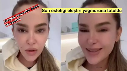 Selin Ciğerci son yaptırdığı estetik ile tanınmayacak hale geldi