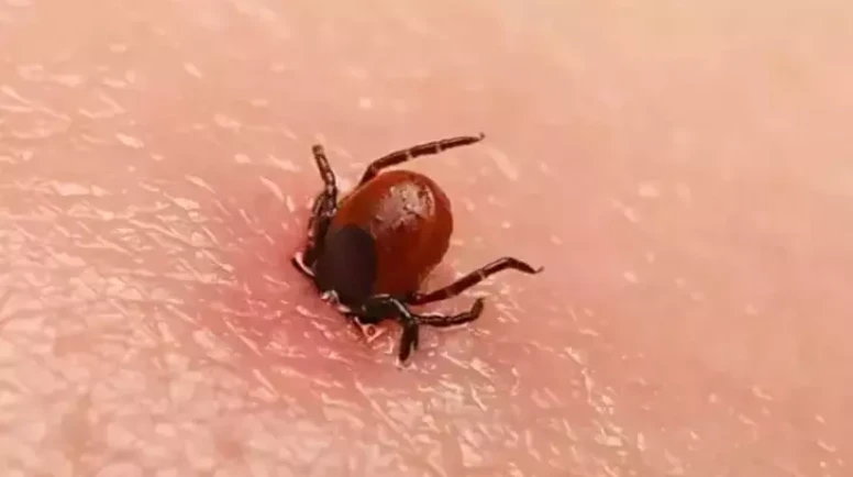 Kenenin ısırdığı 77 yaşındaki kadın hayatını kaybetti